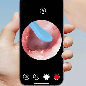 Preview: Akku-Ohrreiniger mit Kamera & 14-tlg. Zubehör – Intelligenter Ohr-Reiniger mit 8MP Kamera, LED-Licht & Echtzeit-Bildübertragung aufs Smartphone