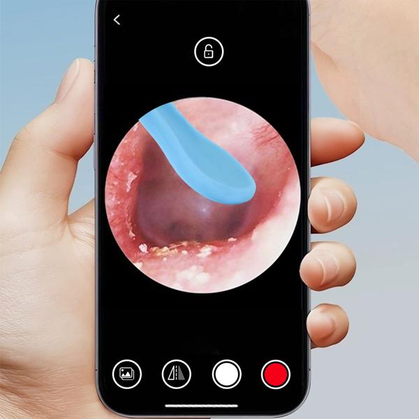 Akku-Ohrreiniger mit Kamera & 14-tlg. Zubehör – Intelligenter Ohr-Reiniger mit 8MP Kamera, LED-Licht & Echtzeit-Bildübertragung aufs Smartphone