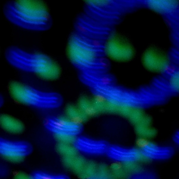 Disco-Lichtprojektor mit Musiksensor und Fernbedienung, verschiedene bunte Lichtmuster, LED Partybeleuchtung mit USB-A für Party und Zimmer