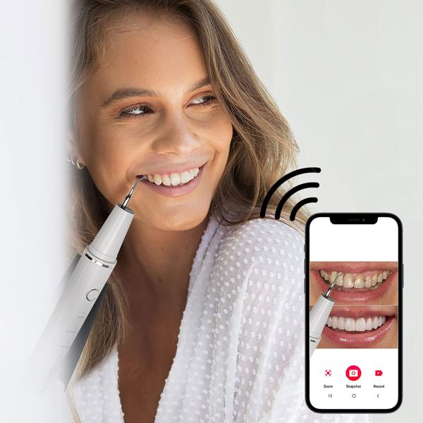 Effektiver Ultraschall-Zahnsteinentferner mit HD-Kamera (weiss): Akku-betriebener Plaque-Entferner für strahlend saubere Zähne