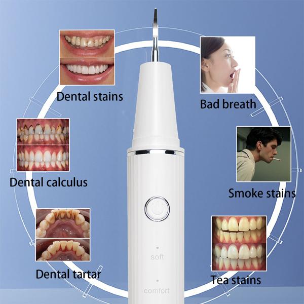 Effektiver Ultraschall-Zahnsteinentferner mit HD-Kamera (weiss): Akku-betriebener Plaque-Entferner für strahlend saubere Zähne